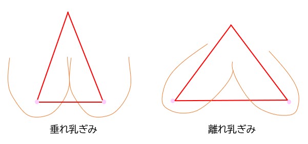 離れ乳卒業 胸の形が横に広がるのはなぜ 原因と改善策まとめ ナイトブラまにあ